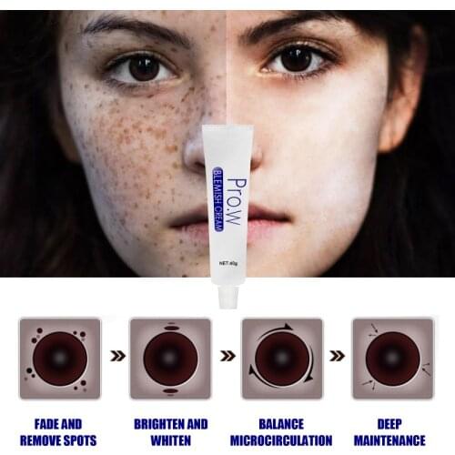 Intensive Anti-freckle Whitening Cream Moisturizing And Removing Freckles Dark Spots And Chloasma Face Care TSLM1