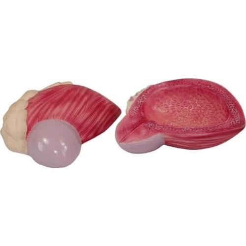 Human Anatomical Expansion Model of Urinary Bladder for Medical Teaching Aid