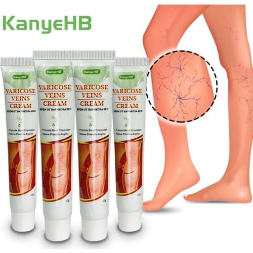 4pcs New Arrivals Varicosity Cream Natural Herbs Remove Feet Varicose Veins Ointment Effective Treatment Leg Varices Cream A642