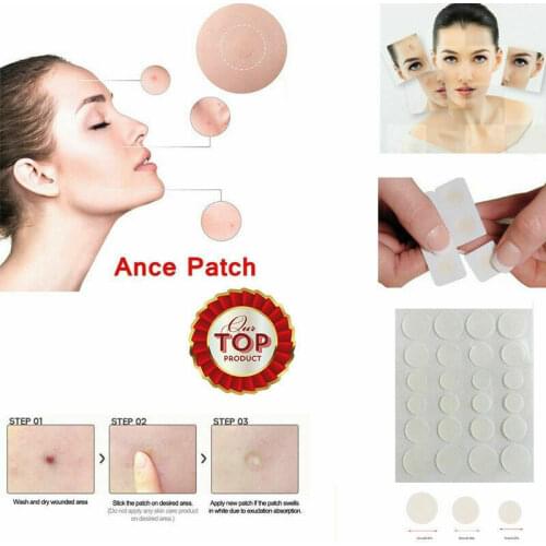 48/72PC Skin Tag Acne Patch NEW Hydrocolloid Acne and Skin Tag Remover Patches