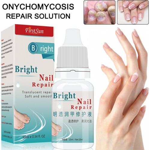 10ml Nail Fungal Treatment Anti Fungus Onychomycosis Removal Toenail Care Nails Repair Liquid MH88