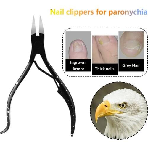 Remover-Scissors Nail-Clipper Trimmers Dead-Skin-Tools Finger-Care Manicure Stainless-Steel Black Manicure Toenails Paronychia