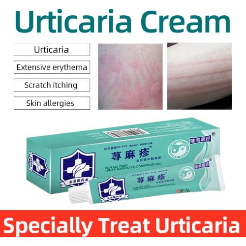 Herbal Medicine Urticaria Ointment Treatment Skin Dermatitis Psoriasis Eczema Urticaria Pruritus Measles Wet Itching Allergy