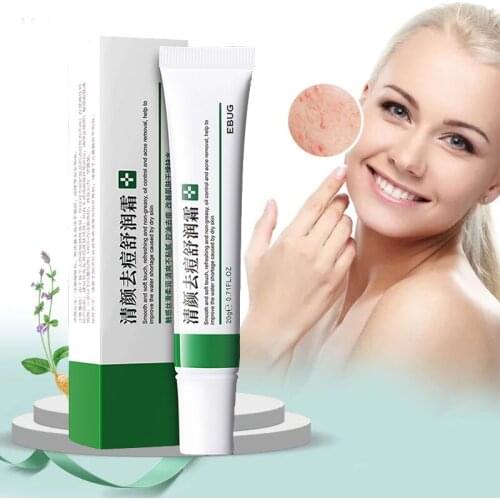 Effective Acne Removal Cream Acne Treatment Fade Acne Spots Oil Control Shrink Pores Whitening Moisturizing Acne Cream Skin Care
