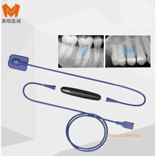 Vatech Ezsensor Soft Dental X-ray Sensor Dental Rvg Sensor