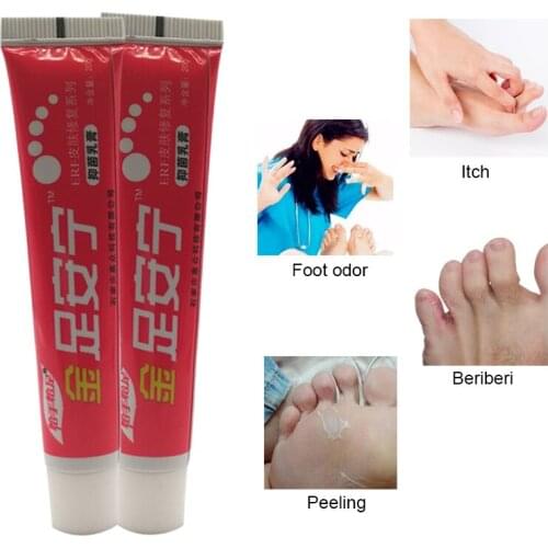 Athletes Foot Psoriasis Dermatitis Cream Deodorants Foot Cream Antibacterial Anti-Itch Sweat Odor Feet Pain Health Care