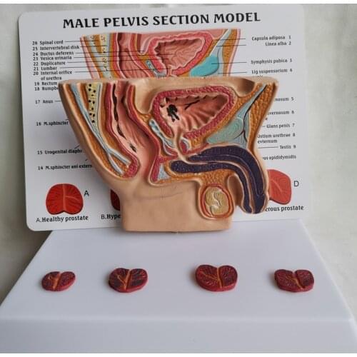 Human Male pelvis section Abdominal Cavity Bladder Prostate Medical Teaching Model Health Illness Comparison Anatomical Model