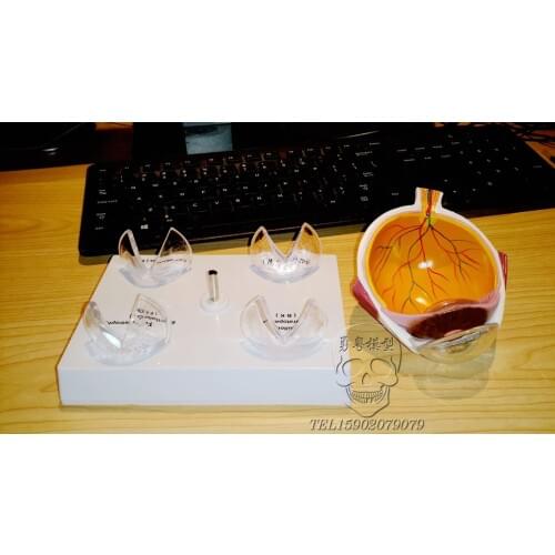 Genuine Human Eye Enlargement Anatomical Model Crystalline lesions Eye disease structure demonstration model