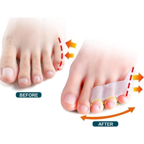2pcs Toe Separator Overlapped Toe Hallux Valgus Correction Bunion Blister Pain Relief Little Finger Protector Foot Care Tool