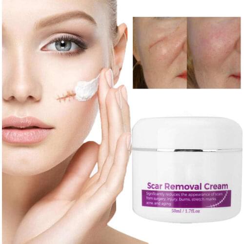 50ml Scar Removal Cream Stretch Marks Remover Cream Scar Repair Removal Cream
