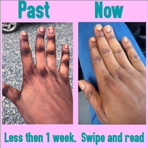 Indian Body Scrub Gel Natural Skin Brightening Lemon Kojic Acid Scrub Super Whitening Cream To Remove Darkness Knuckles