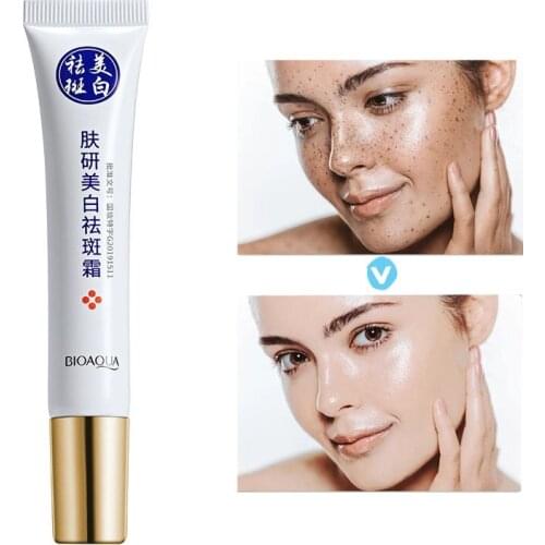 Powerful Whitening Freckle Cream Remove Melasma Acne Spot Pigment Melanin Dark Spots Pigmentation Moisturizing Gel Skin Care