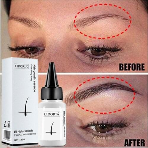20ml Fast Hair Growth Serum Anti Preventing Hair Lose Liquid Damaged Hair Repair Treatment Eyelash Eyebrow Growing Thick Care