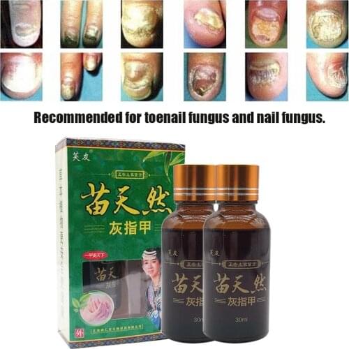 30ML Natural Herbal Nail Health Liquid Treats Onychomycosis Premium Concentrated External Use Protects Nails Health Care
