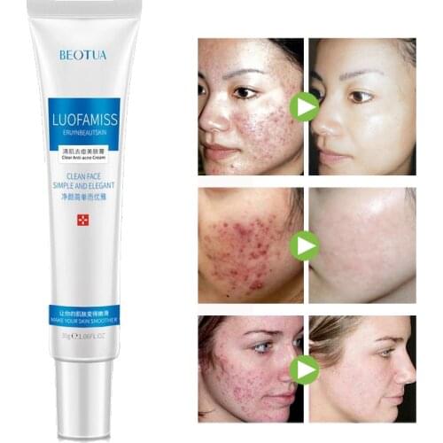 30g Face Care Gel Skin Care Face Cream Anti Winkle Whitening Moisturizing Acne Treatment Day Cream Shrink Pores