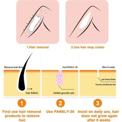 20ML Hair Stop Serum Permanent Painless Hair Removal Shrink Pores Growth Spray Smooth Inhibitor Repair Hair Essence Skin St E7A3