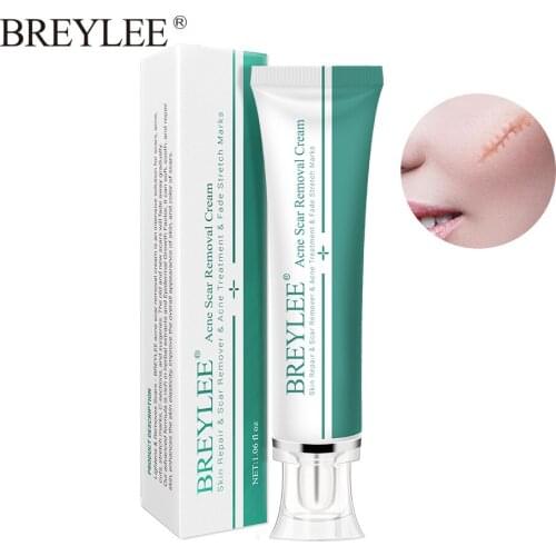 30g Acne Scar Removal Cream Skin Repair Face Cream Acne Spots Acne Treatment Blackhead Whitening Cream Stretch Marks
