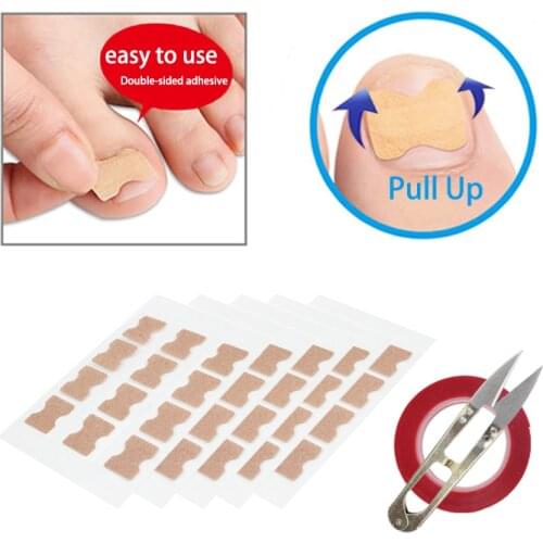 NEW Double-sided tape Ingrown Toenail Correction Tool Set Nail Pedicure Elastic Patch Straightening Clip Brace Bunion Corrector