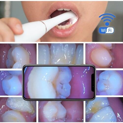 1280*720 Wireless Oral Endoscope Waterproof Wifi Dental Intraoral Intra Oral Camera USB Charging