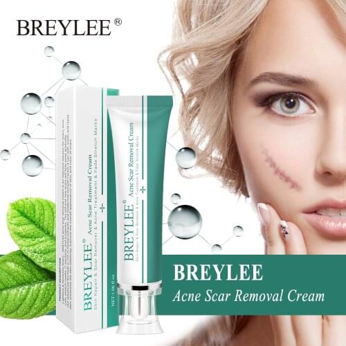 30g BREYLEE Acne Scar Removal Cream Face Cream Skin Repair Skin Care Scar Acne Treatment Remove Stretch Marks Whitening Cream