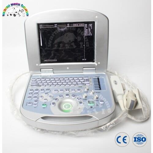 12 Inch LCD Display screen Portable Notebook Ultrasound 96 Element Equipped with Linear Convex Microconvex Probe