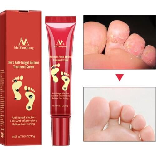 15g Foot Repair Anti Crack Whitening Cream Foot Peeling Cracked Hands Feet Dry Skin Moisturizing Care
