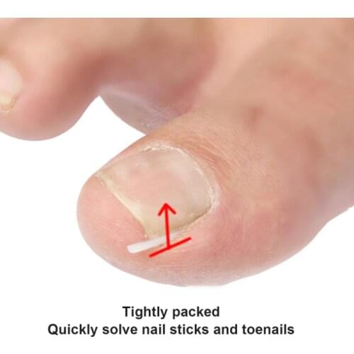 10Pcs/Set Professional Ingrown Nail Pad Flexible Silicone Nail Filling Nail Groove Pad Ingrown Nail Corrector High Qulity