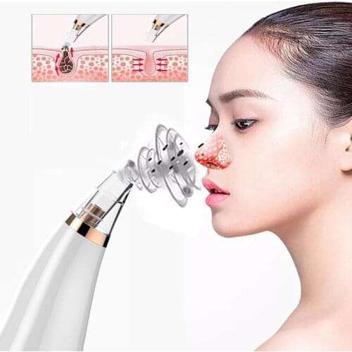 Blackhead Remover Nose T Zone Pore Face Deep Cleaner Pore Acne Pimple Removal Vacuum Suction Facial Beauty Clean Skin Tool
