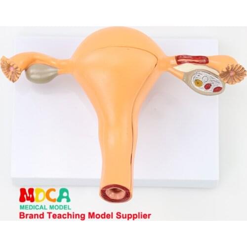 Medical teaching of anatomical model of uterus and genitalia in family planning of human uterus and reproductive model MSZXT005