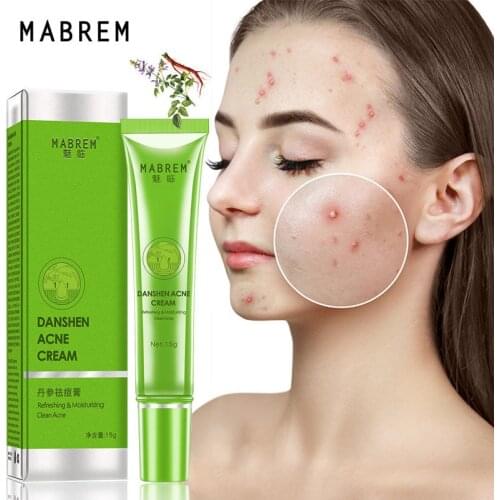 Anti Acne Removal Cream Acne Treatment Fade Acne Spots Oil Control Shrink Pores Whitening Moisturizing Acne Cream Skin Care 15g