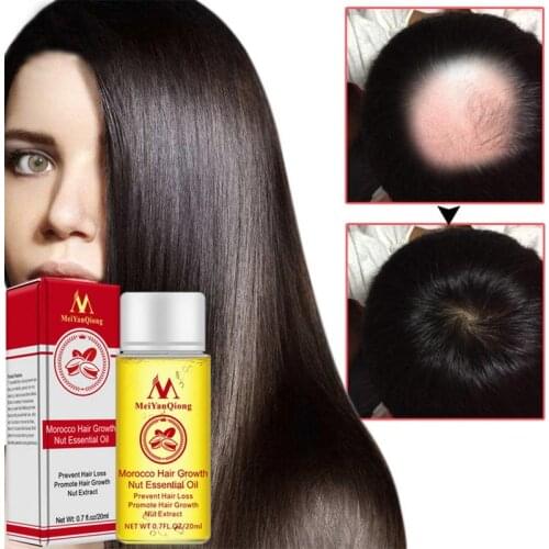 Hair Growth Products Ginger Faster Grow Hair Shampoo