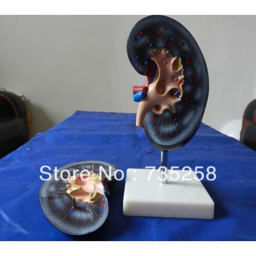 Kidney Model (2 parts),Two Parts Kidney Anatomical Model