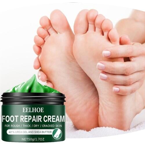 15/30/50g Dry Skin Treatment Cream Foot Anti-Dry Crack Foot Cream Heel Peel Cracked Repair Cream Removal Dead Skin Feet Care 304