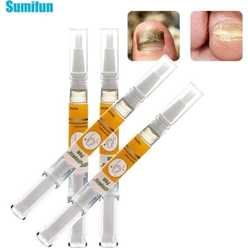 Hand Foot Nail Fungus Oil 5ML Onychomycosis Remove Liquid Nail Drop Repair Essence Anti Infection Paronychia Treatment Gel