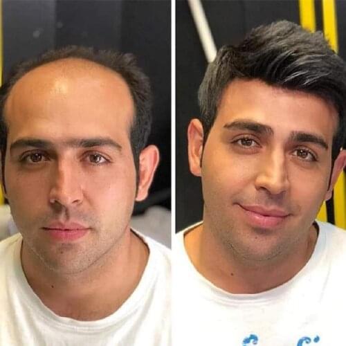 Mono Base Pu Replacement System Wig For Handsome Man Hair Toupee Men Natural Looking Human Hair Natural Hair Toupee