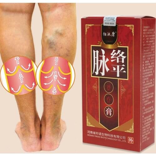 Varicose Veins Treatment Cream Varicosity Angiitis Remedy Ointment Relief Veins Pain Phlebitis legs Varicose Veins Cream