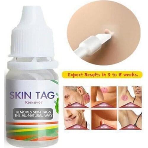 10ML Body Warts Treatment Cream Skin Tag Remover Foot Corn Removal Plantar Genital Warts Ointment Foot Care Cream Dropshopping