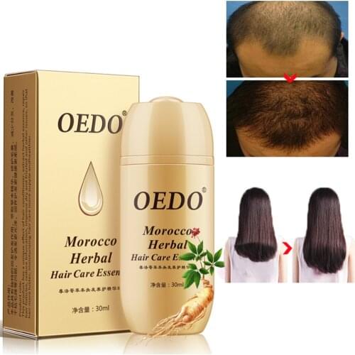 30ml Morocco Herbal Hair Nourishment Hair Growth Fluid Hair Care Effective Fast Hair Growth Essence