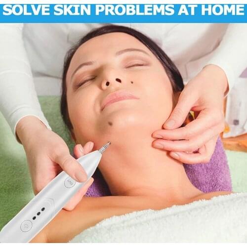 Beauty Instrument Laser Freckle Removal Machine Skin Mole Removal Dark Spot Remover for Face Wart Tag Tattoo Remaval Pen