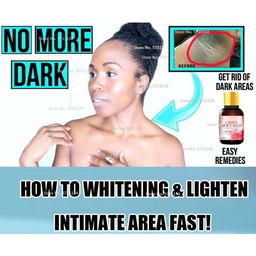 Skincare Intimate Skin Lightening & Whitening Cream Serum for Hyperpigmentation