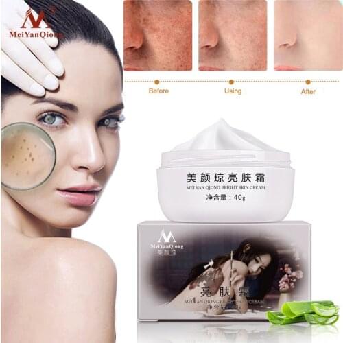 MeiYanQiong Powerful Remove Freckle Whitening Cream Remove Melasma Dark Spots Pigment Melanin Strong Effects Brightening Cream