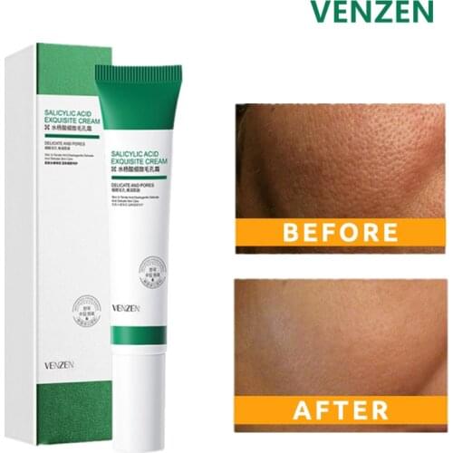 Salicylic Acid Essences Creams Lighten Acne Marks Pore Refining Whitening Cream Skin Care Rejuvenation Anti Wrinkle Moisturizer