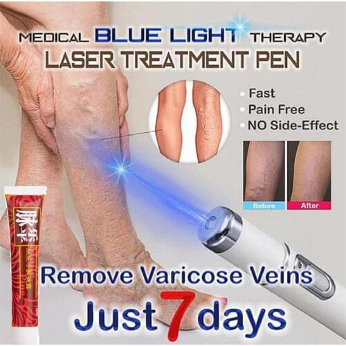 1pc Medical Blue Light Therapy Laser Pen add 1Pc Varicose Veins Treatment Cream Soft Scar Wrinkle Removal Treatment Just 7 Days