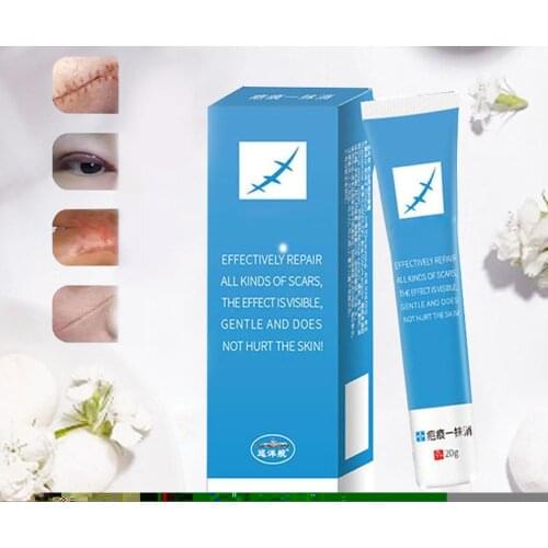 LAIKOU Scar Removal Cream For Face Acne Scar Stretch Skin Scar Remover Burn Face Cream Acne Cream Repair Surgical Marks Spo P7J7