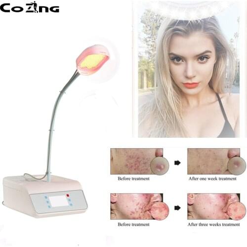 PDT LED Light 2 Color Facial Salon Machine Skin Care For Home Use