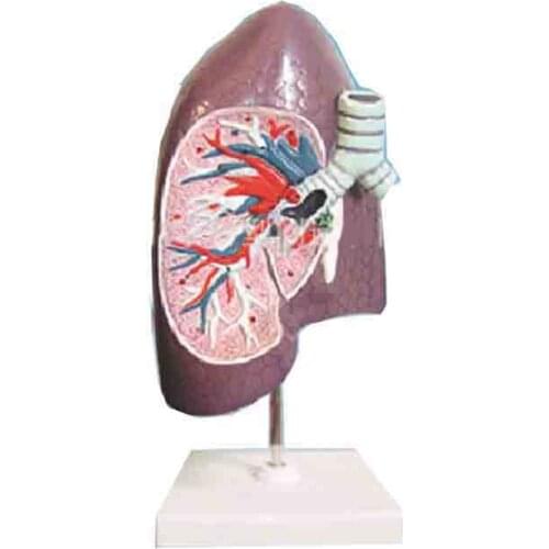 Anatomical model of bronchus and right lung