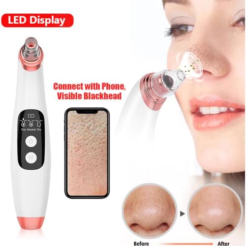 USB Vacuum Suction Blackhead Remover Nose Facial Pore Cleaner Spot Acne Black Head Pimple Removal Beauty Face Skin Care Tools