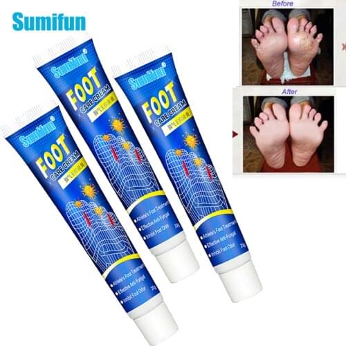 Sumifun 1/3 Pcs Foot Care Cream for Athletes Foot Odor Feet Itch Blisters Peeling Beriberi Bad Feet Chinese Medicine Ointment