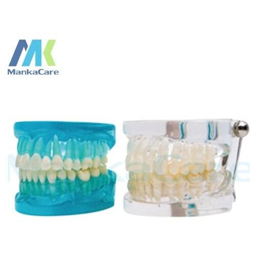 Manka Care - Standard Model Oral Model Teeth Tooth Model