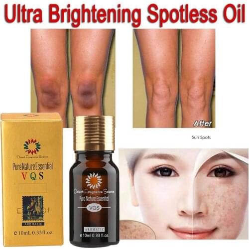 1PCS Ultra Brightening Spotless Rose Complex Oil Skin Care Ance Spots Remove Removal Burn Dark Scar Marks Strentch W8J9